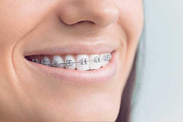 Best Wisdom Tooth Removal  in Tilden, NE